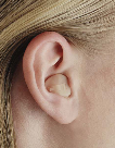 Image of a person wearing an in the canal hearing aid