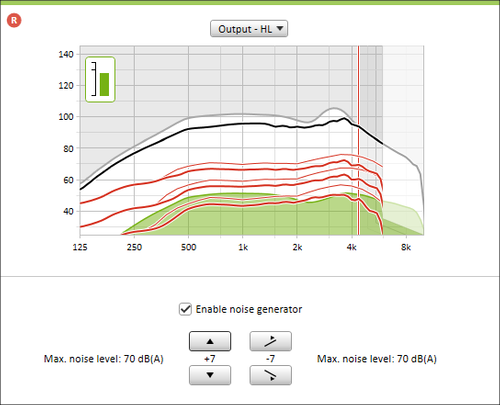 Image showing an extract from Phonak Target fitting software