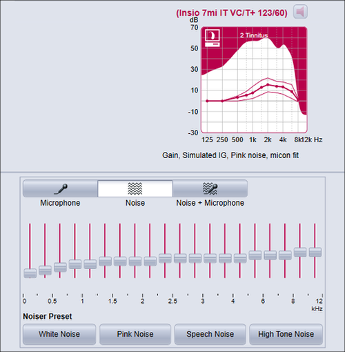 siemens tinnitus hearing software connexx fitting aids management adjust lack binax controls ace generator output external possible sound